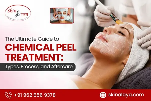 chemical-peel-treatment