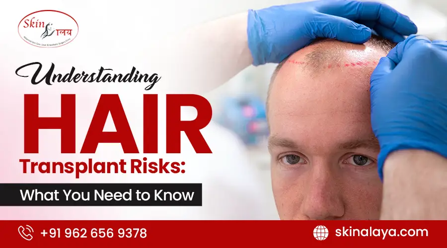 hair-transplant-risks