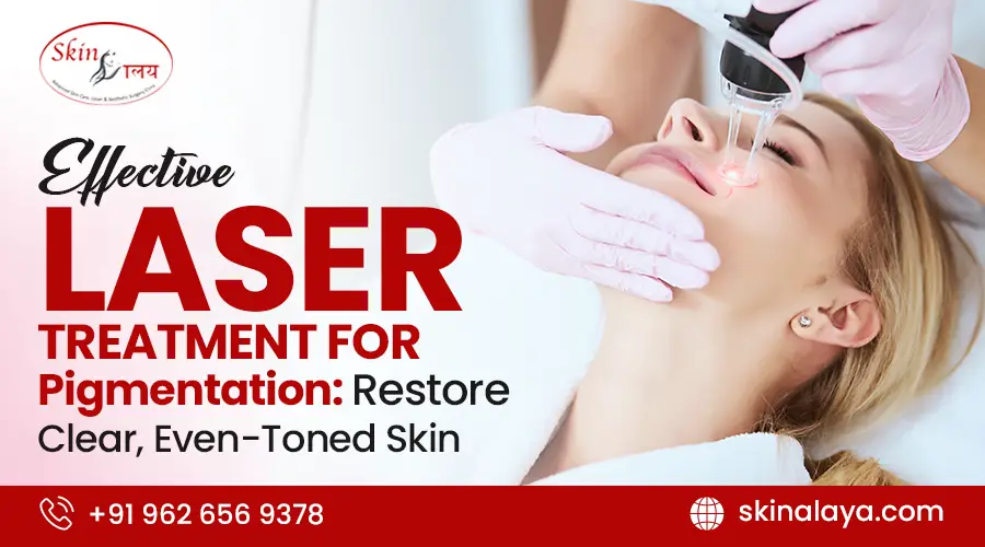laser treatment for pigmentation
