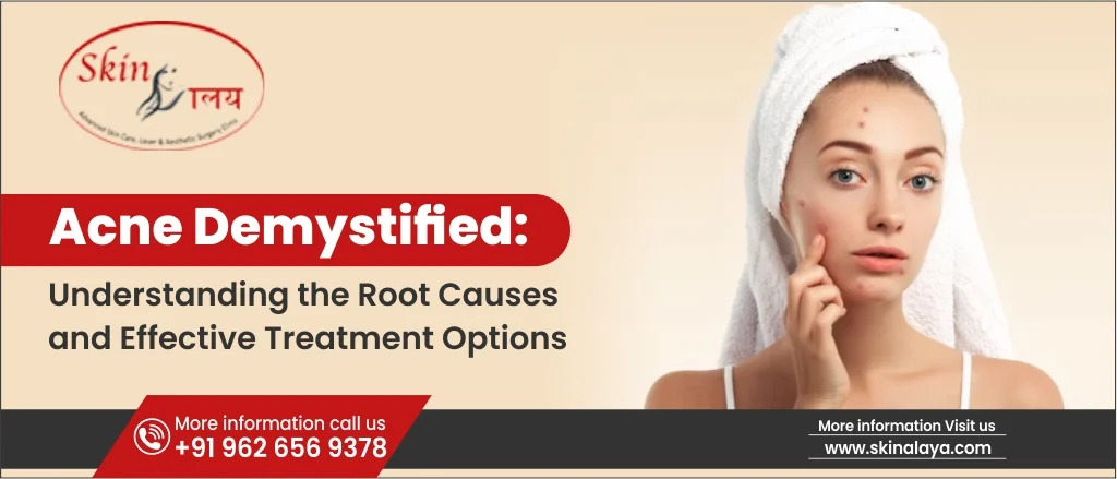 understanding-the-root-causes-and-effective-treatment-options